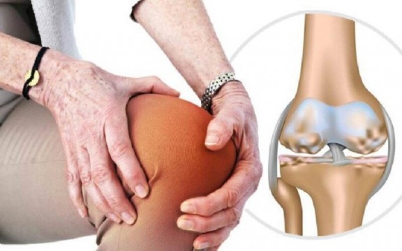 Tìm Hiểu Về Hiện Tượng Khô Khớp Gối Ở Người Trẻ
