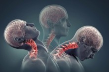 Đau Cổ: Các Vị Trí Đau Ở Cổ, Nguyên Nhân, Chẩn Đoán Và Cách Điều Trị 