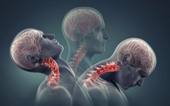 Đau Cổ: Các Vị Trí Đau Ở Cổ, Nguyên Nhân, Chẩn Đoán Và Cách Điều Trị 