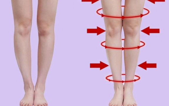 Mẹo Chữa Chân Vòng Kiềng Cho Mọi Lứa Tuổi 