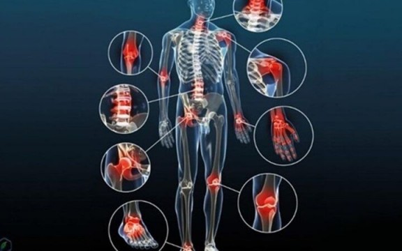 Giải đáp nguyên nhân thoái hóa khớp xuất phát từ đâu?