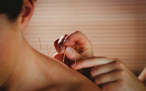 Những Ai Không Nên Châm Cứu? Tác Hại Khi Châm Cứu Không Đúng Cách