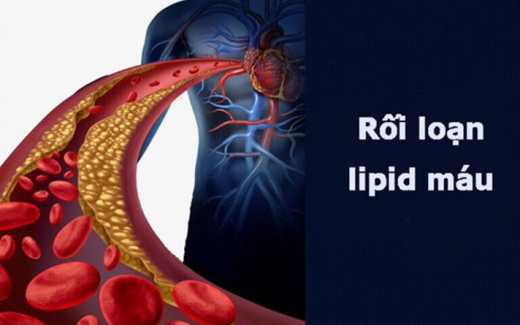 Rối loạn chuyển hóa lipid là gì? Dấu hiệu rối loạn chuyển hóa lipid máu?
