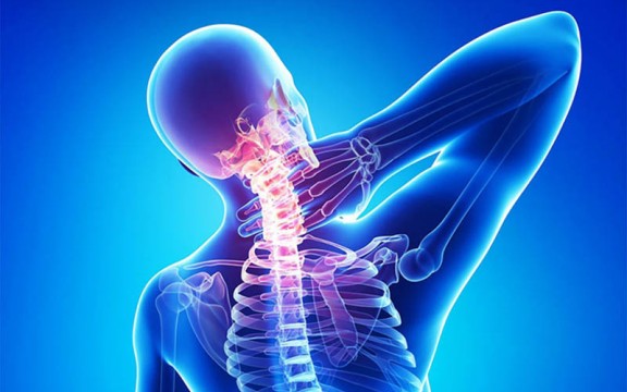 Nhận biết triệu chứng vôi hóa đốt sống cổ và cách phòng tránh
