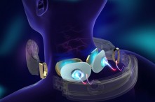 Thực hư hiệu quả của phương pháp xung điện kép TENS và EMS 