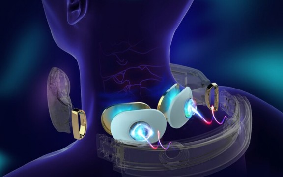 Thực hư hiệu quả của phương pháp xung điện kép TENS và EMS 