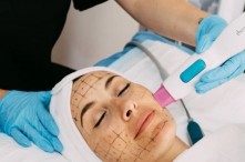 Thermage Là Gì? Thermage Flx Giữ Được Bao Lâu? Tác Dụng Phụ của Thermage?