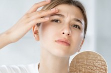 Cách Phân Biệt Da Dầu Và Da Khô Chính Xác Từ Chuyên Gia
