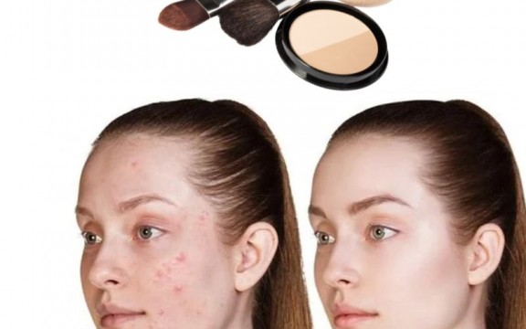 Cách Trang Điểm Cho Da Mụn Thâm Tự Nhiên, An Toàn Và Không Gây Kích Ứng