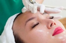 Cấy Collagen Tươi Giữ Được Bao Lâu? Cách Chăm Sóc Da Sau Khi Cấy Collagen
