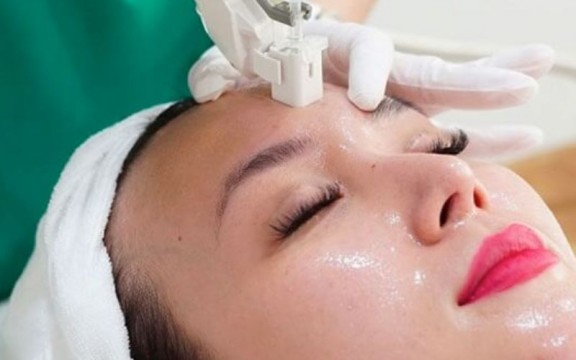 Cấy Collagen Tươi Giữ Được Bao Lâu? Cách Chăm Sóc Da Sau Khi Cấy Collagen