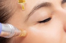 Làm PRP Bao Lâu Thì Đẹp? Tiêm Huyết Tương Giàu Tiểu Cầu Làm Đẹp Da Bao Lâu 1 Lần?
