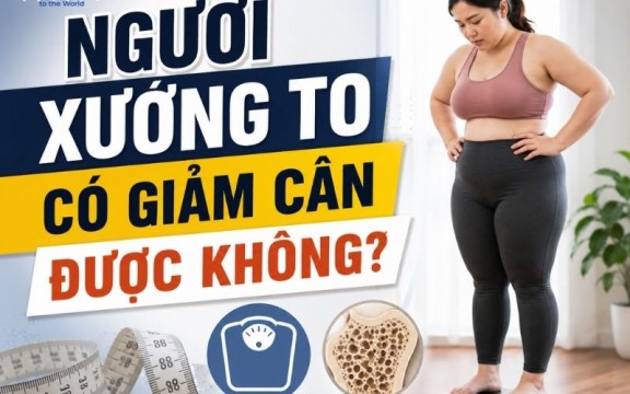 Người xương to có giảm cân được không? Cách giảm cân cho người xương to
