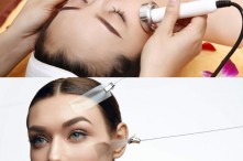 So Sánh Phương Pháp Điện Di Tinh Chất Và Căng Da Mặt (Face Lift)