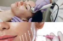 So Sánh Phương Pháp Điện Di Tinh Chất Và Cấy Chỉ Collagen