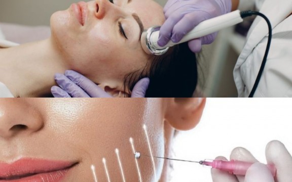So Sánh Phương Pháp Điện Di Tinh Chất Và Cấy Chỉ Collagen
