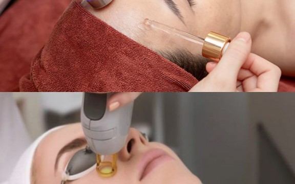 [Góc So Sánh] So Sánh Phương Pháp Điện Di Tinh Chất Và Laser CO2