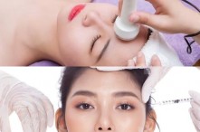So Sánh Phương Pháp Điện Di Tinh Chất Và Tiêm Filler, Botox