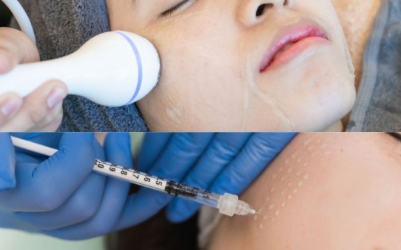 [Góc So Sánh] So Sánh Phương Pháp Điện Di Tinh Chất Và Tiêm Vi Điểm