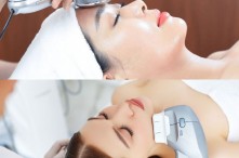 So Sánh Phương Pháp Điện Di Tinh Chất Và HIFU
