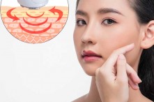 Sóng EMS Có Hại Không? Tham Khảo Ý Kiến Từ Chuyên Gia Đầu Ngành