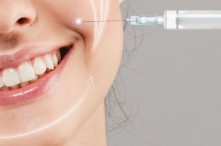 Tiêm Rãnh Cười Bao Lâu Thì Đẹp? Có Biến Chứng  Tiêm Filler Rãnh Cười Không?