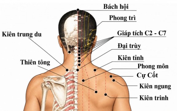 Vị Trí Các Huyệt Vùng Vai Gáy Quan Trọng Trên Cơ Thể