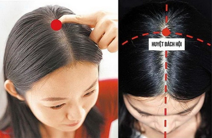 Huyệt bách hội