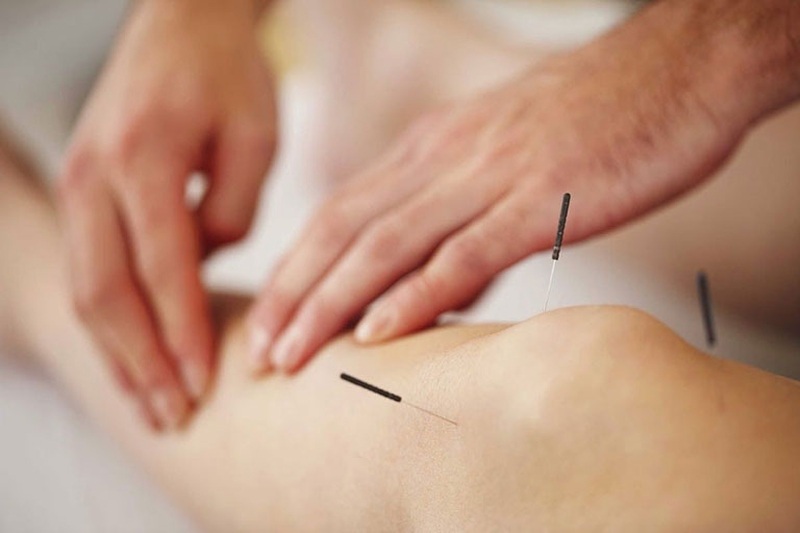 châm cứu huyệt huyết hải