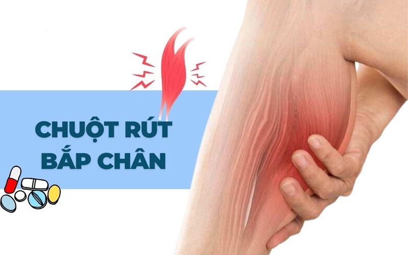 Hỗ trợ giảm co cứng và chuột rút bắp chân