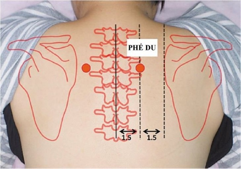 5 điều cần biết về huyệt Phế Du trước khi tự bấm huyệt tại nhà