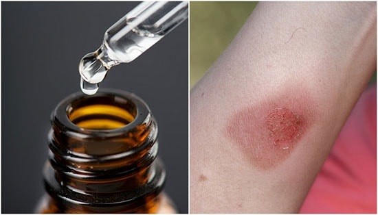 Kiểm tra dị ứng với tinh dầu trước khi sử dụng