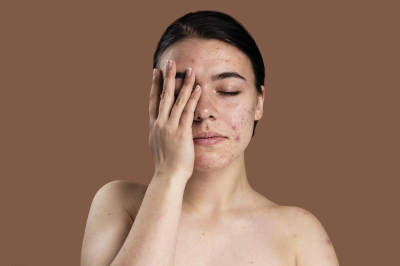 không massage khi da đang bị tổn thương