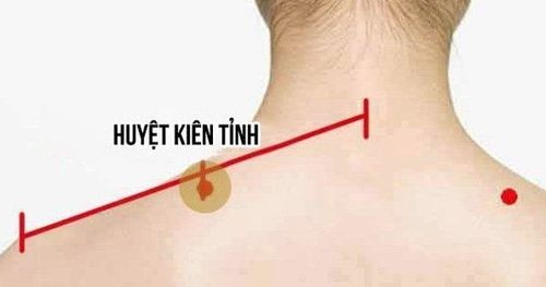 Huyệt Kiên Tỉnh: Điểm day bấm giúp thư giãn cổ vai gáy hiệu quả