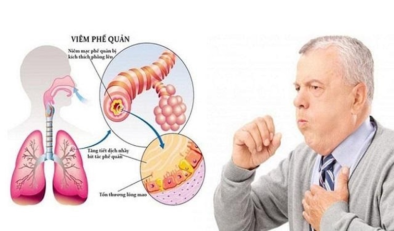 Tăng cường chức năng hô hấp