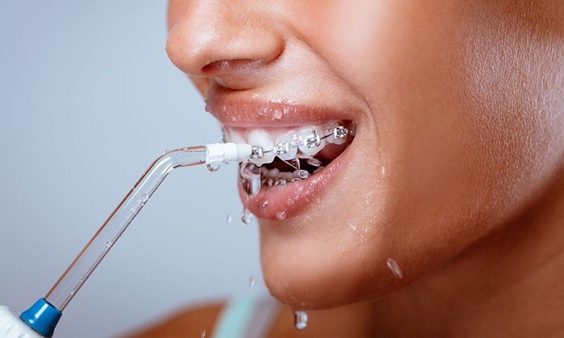 Mỗi cấu trúc khoang miệng và tình trạng sức khỏe răng nướu của từng cá nhân sẽ tương thích với một mức áp lực nước