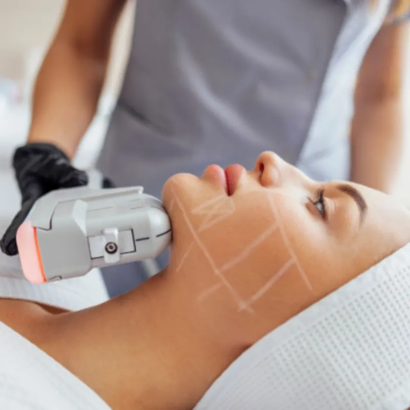 Đối với tuổi 40, nên thực hiện HIFU 3 lần mỗi năm