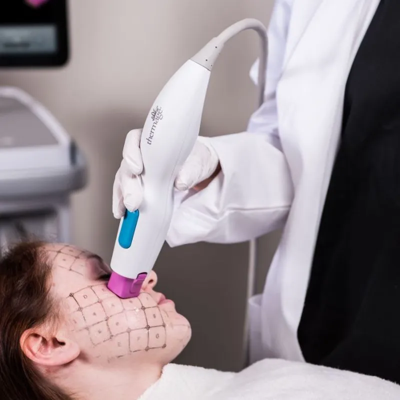 Thermage FLX Là Gì?