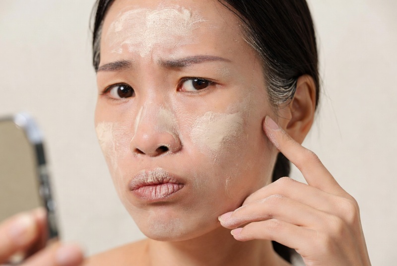 Một trong những nguyên nhân phổ biến nhất là làn da thiếu độ ẩm