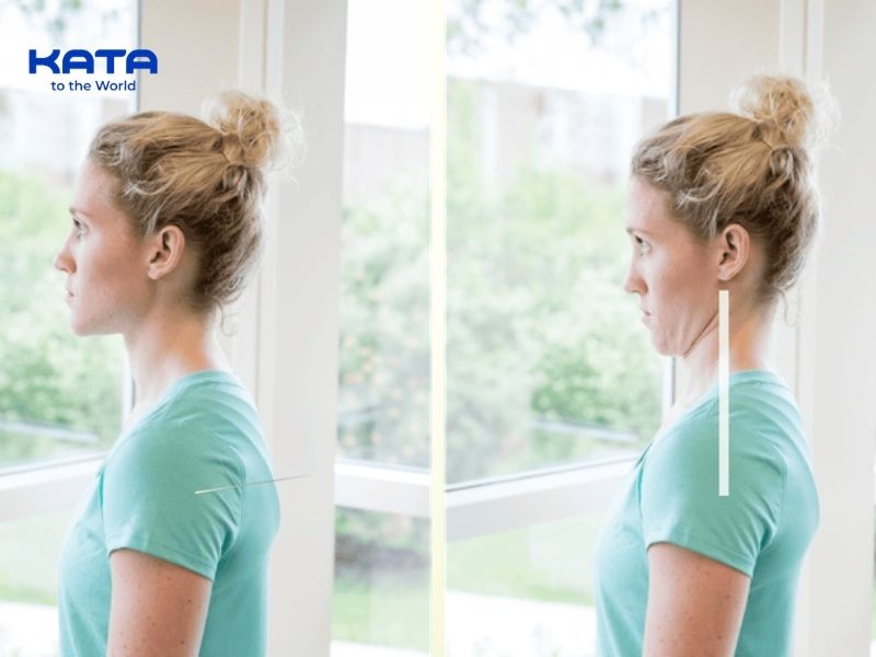 Hướng dẫn bài tập Chin Tuck cải thiện cổ rùa