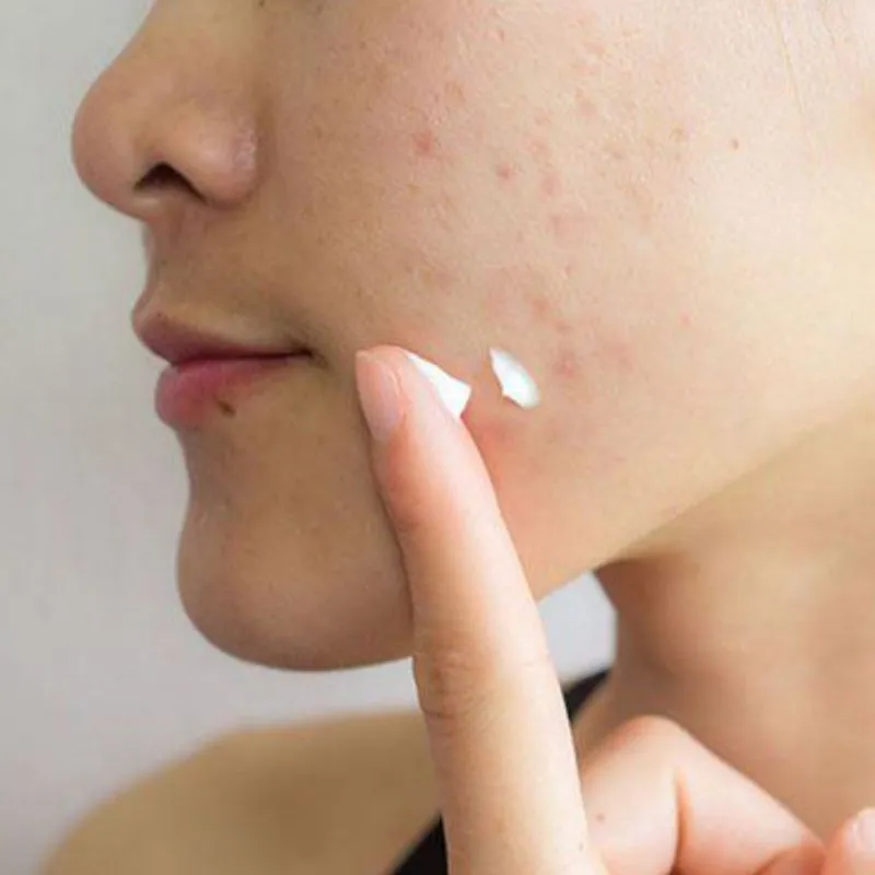 Các bước dưỡng da ban đêm cho da khô