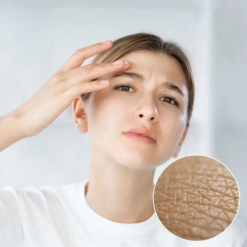 Cách Phân Biệt Da Dầu Và Da Khô Chính Xác Từ Chuyên Gia