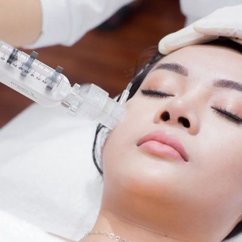 Cấy collagen là phương pháp làm đẹp hiệu quả