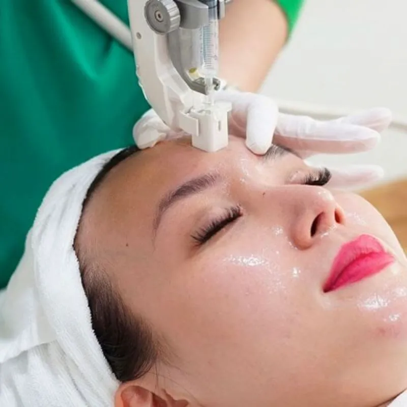 Cấy Collagen Tươi Giữ Được Bao Lâu? Cách Chăm Sóc Da Sau Khi Cấy Collagen