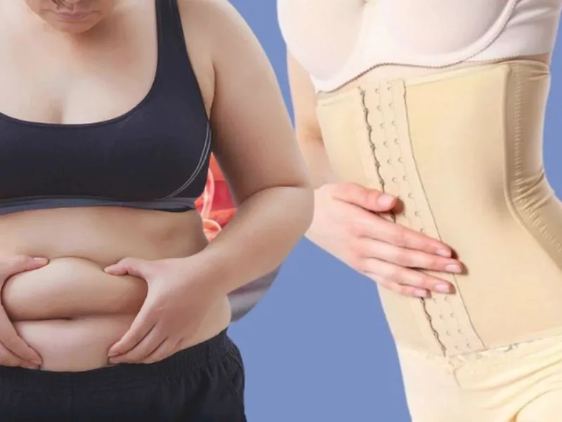 Đeo nịt bụng có giảm eo không?