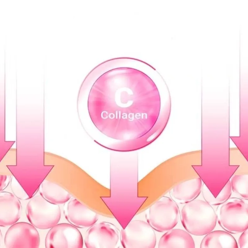 Điện di collagen là gì