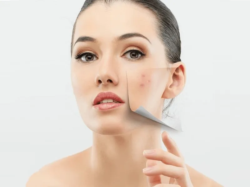 Phục hồi da tổn thương