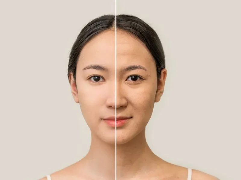 Giúp làm trẻ hóa làn da và giảm nếp nhăn