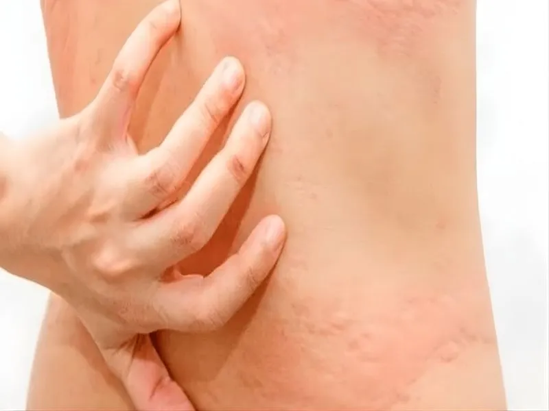 Vì sao dùng máy massage lại bị ngứa dù mới dùng vài phút?