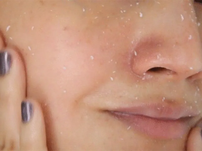 Dễ bị vón cục gây mất thẩm mỹ